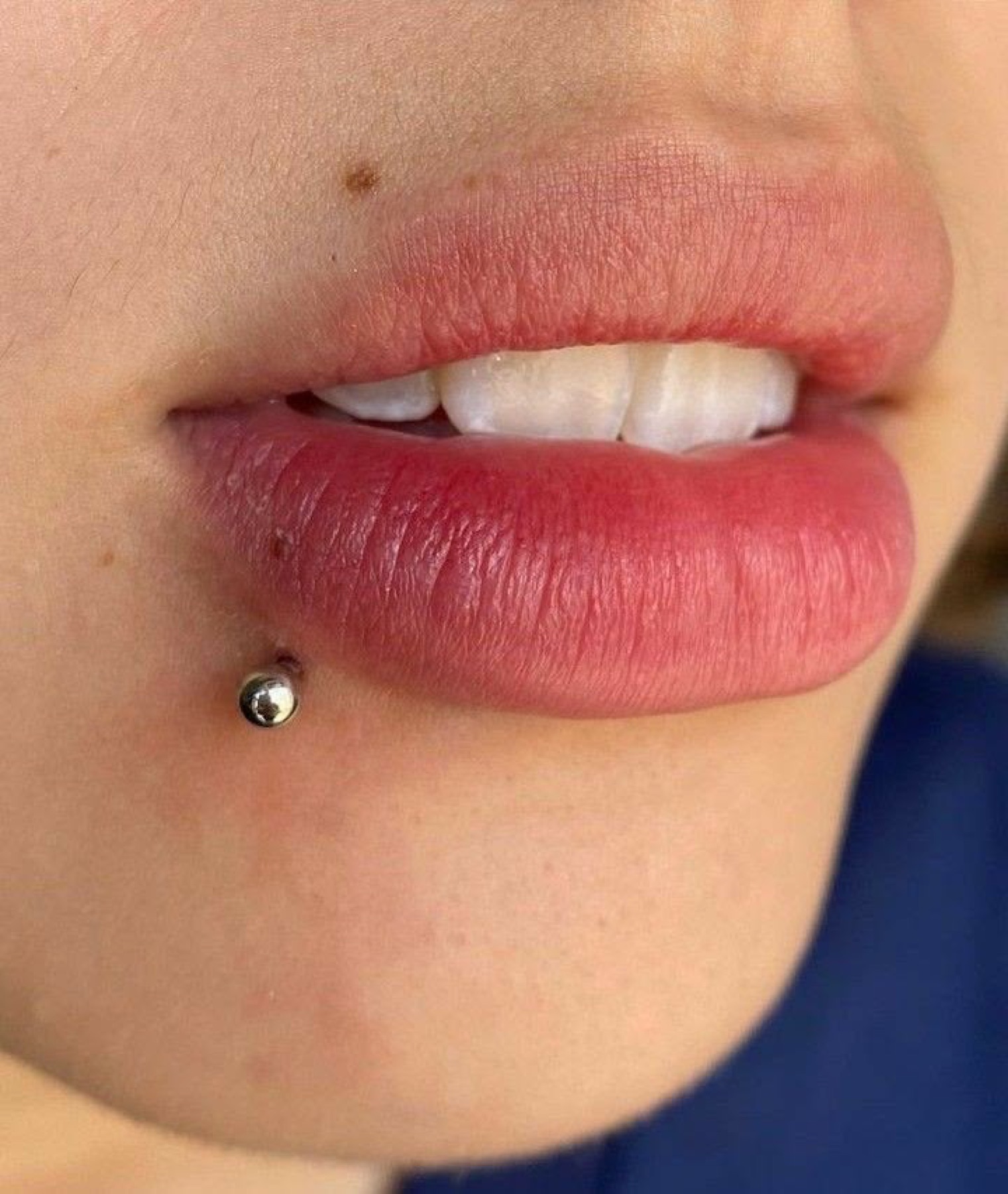 Lower lip piercing