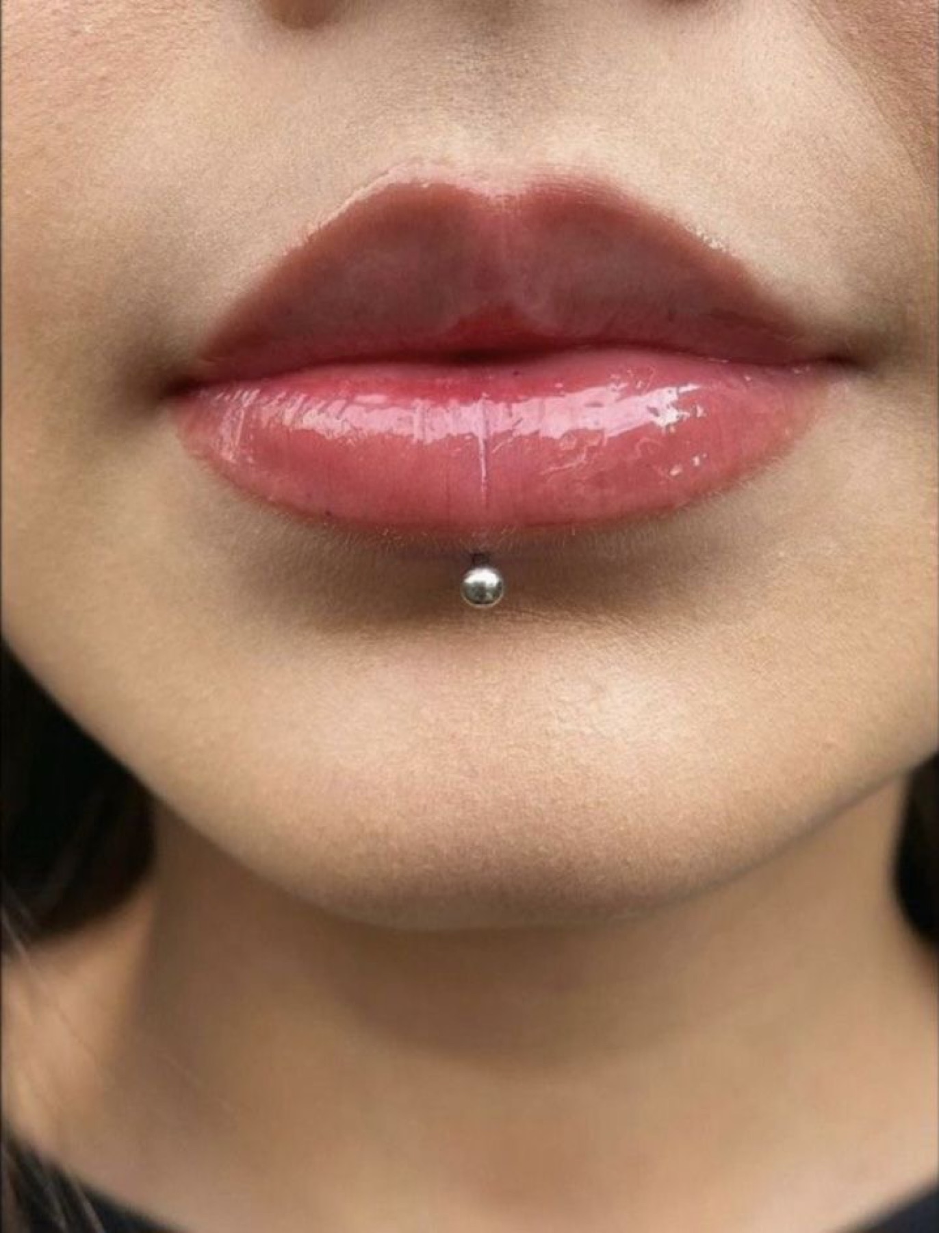 Labret piercing below the lower lip